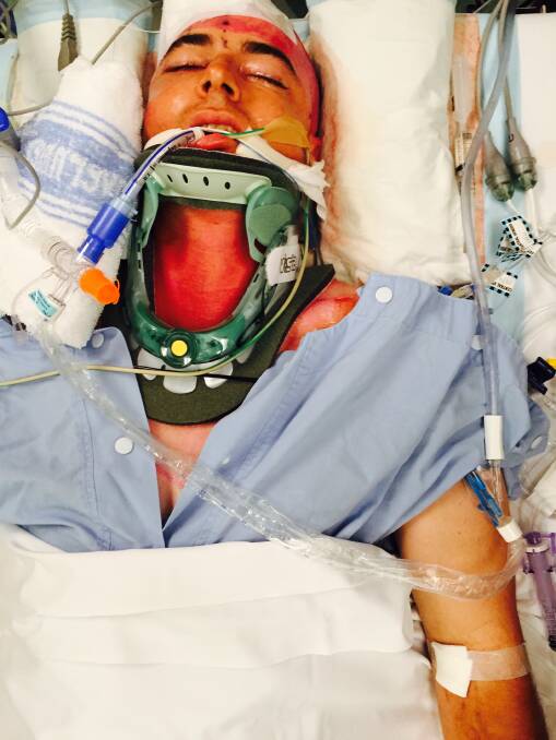 Matt spent eight days in the intensive care unit following the accident.