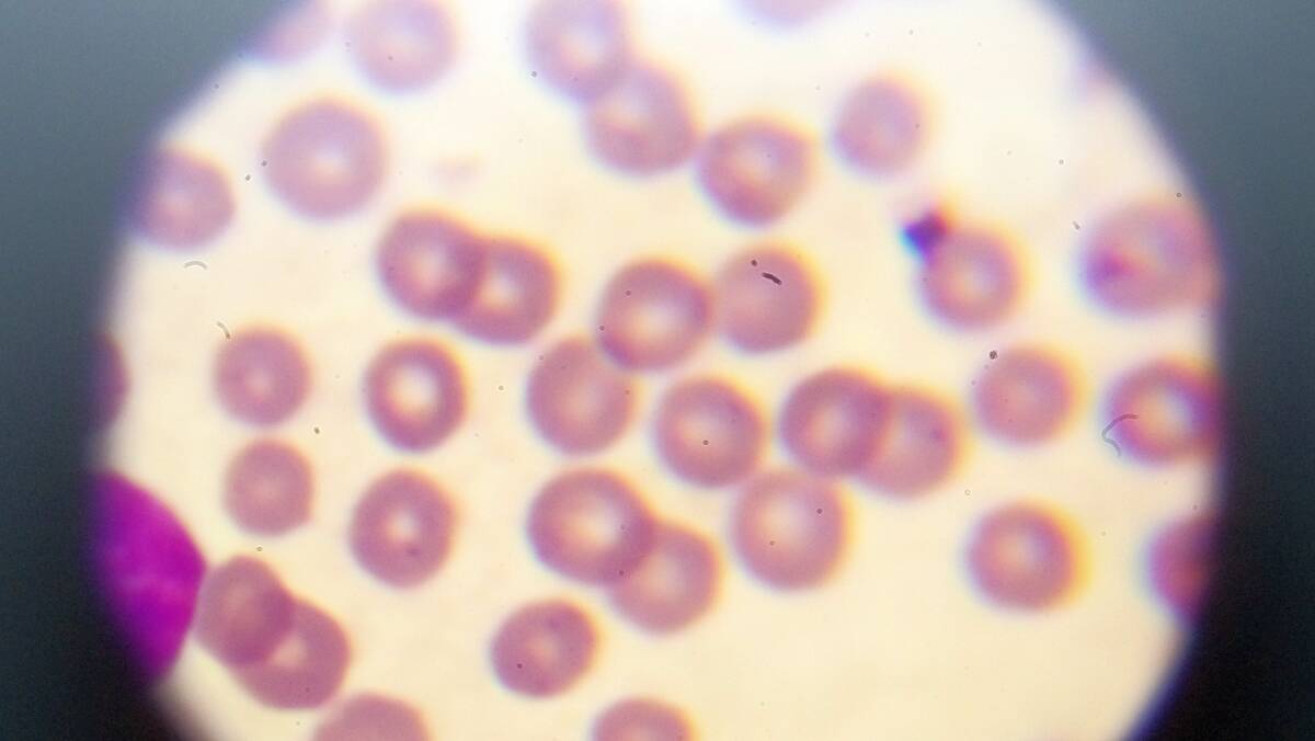 DISEASE: Theileria in a blood smear.