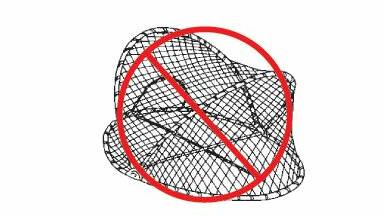 Like yabbying? Take note – opera house nets to be banned in 2019